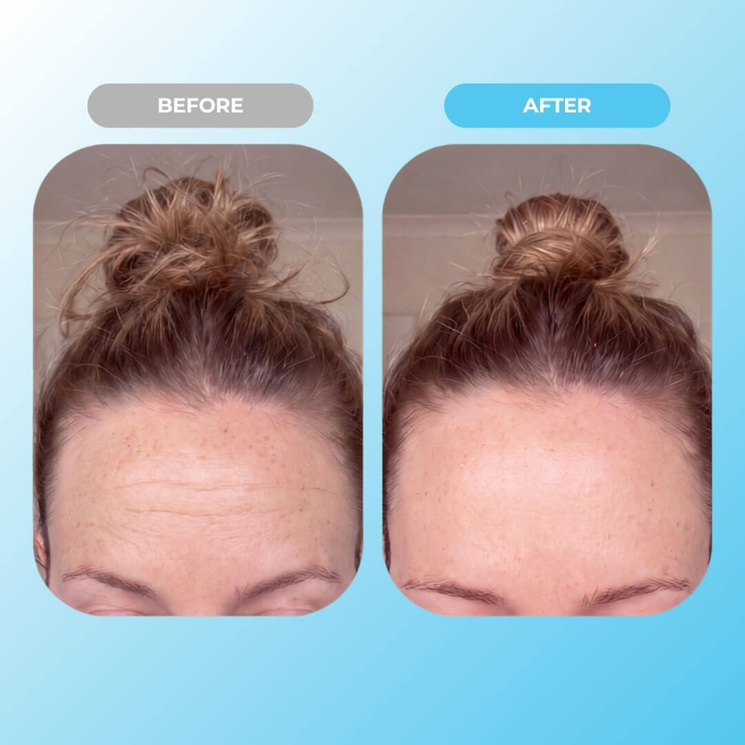 Goodnight Collagen Face Tape